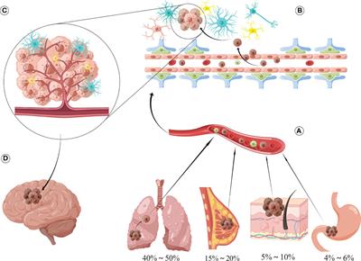 Tumor microenvironment and exosomes in brain metastasis: Molecular mechanisms and clinical application